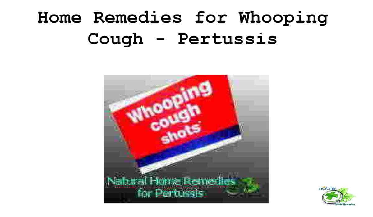 whooping-cough-best-10-home-remedies-noble-home-remedies