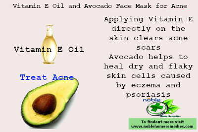 Acne fighting diy face mask