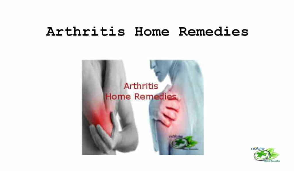 Arthritis Home Remedies