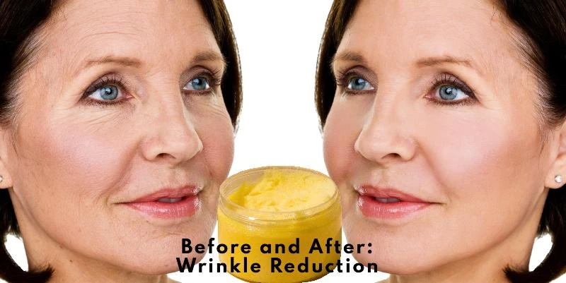 Banana for Wrinkles - Before and After Wrinkles