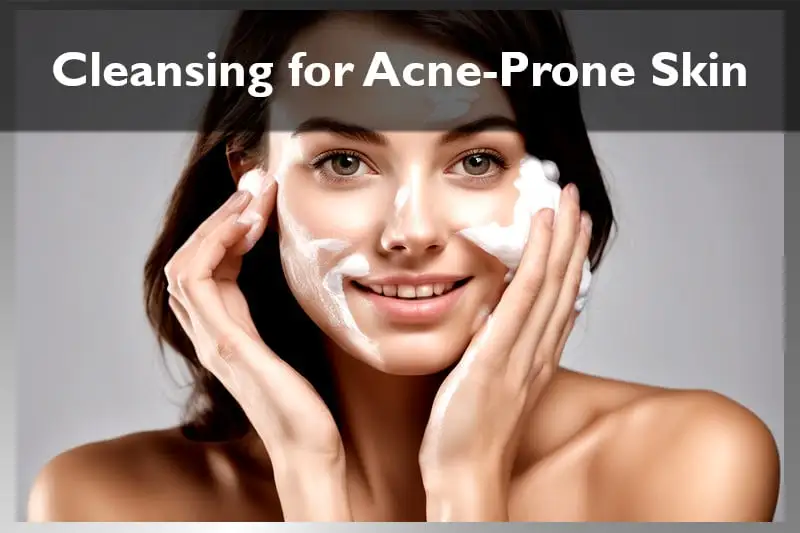 Cleansing for Acne Prone Skin