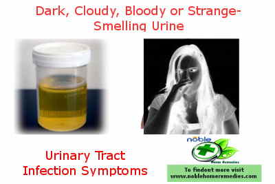 Dark Cloudy Bloody or Strange -Smelling Urine - UTI Symptoms