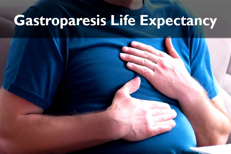 Gastroparesis Life Expectancy