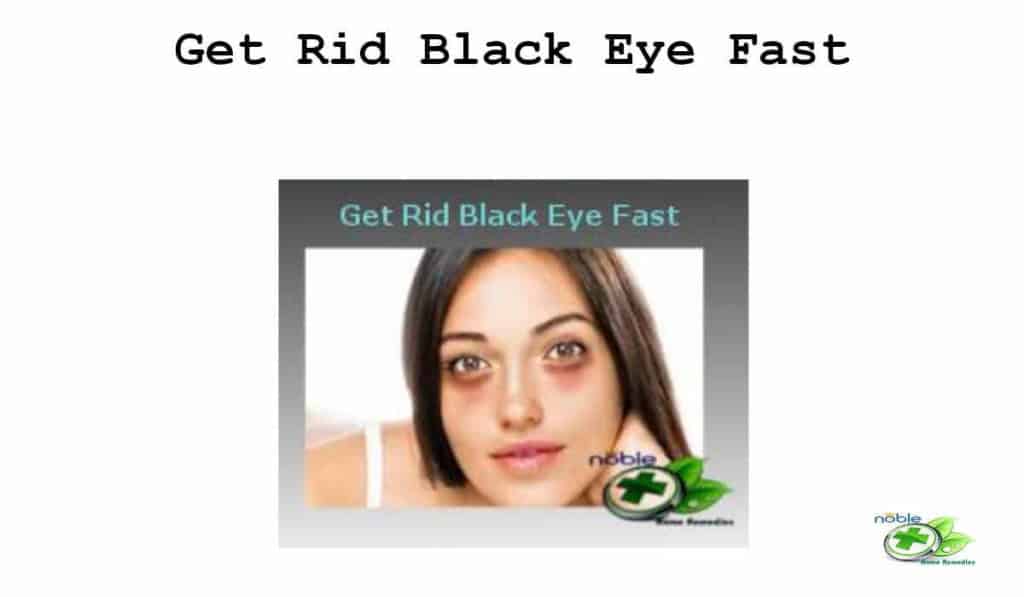 Get Rid of a Black Eye Fast