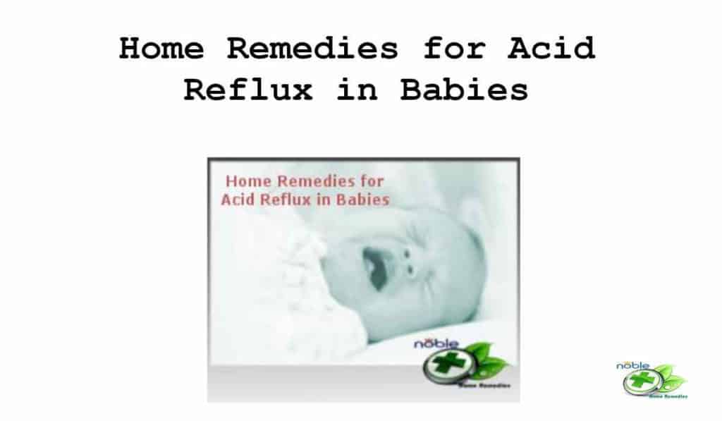 Home Remedies for Acid Reflux in Babies