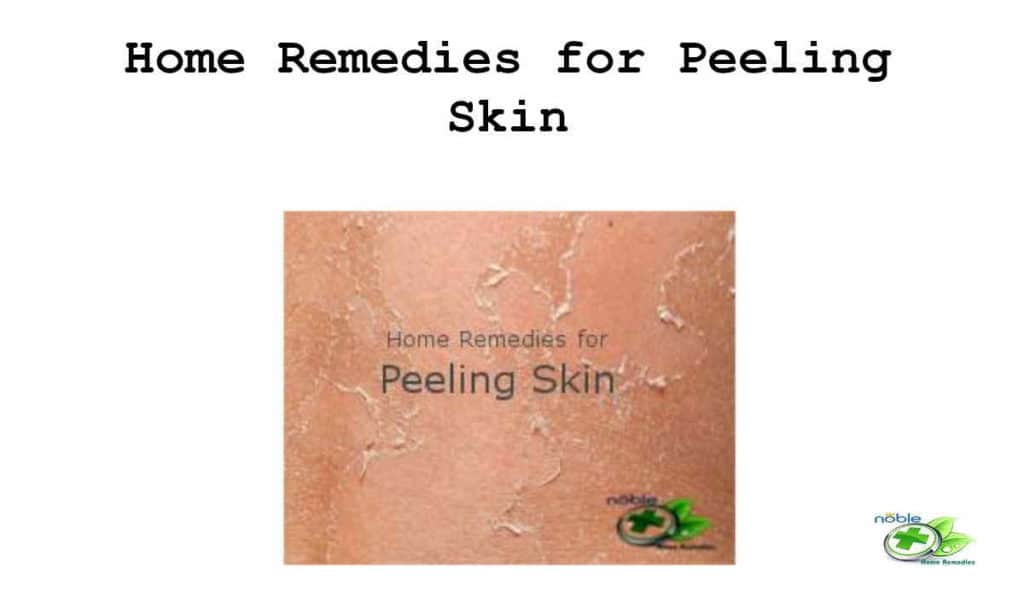 Get rid of peeling skin naturally, fast and safe