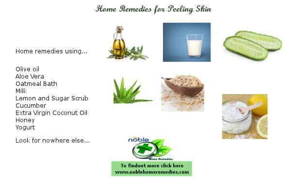 Peeling Skin 9 Natural Ways To Get Rid Of Peeling Skin Fast 