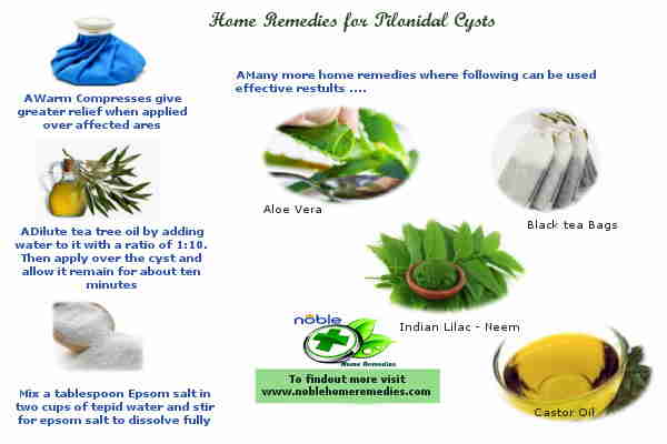 Home Remedies for Pilonidal Cysts Guide