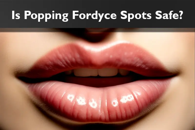 Is Popping Fordyce Spots - Lips