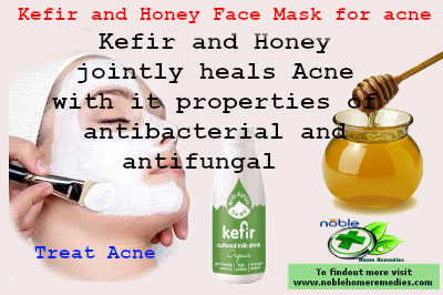 Kefir and Honey Face Mask for acne