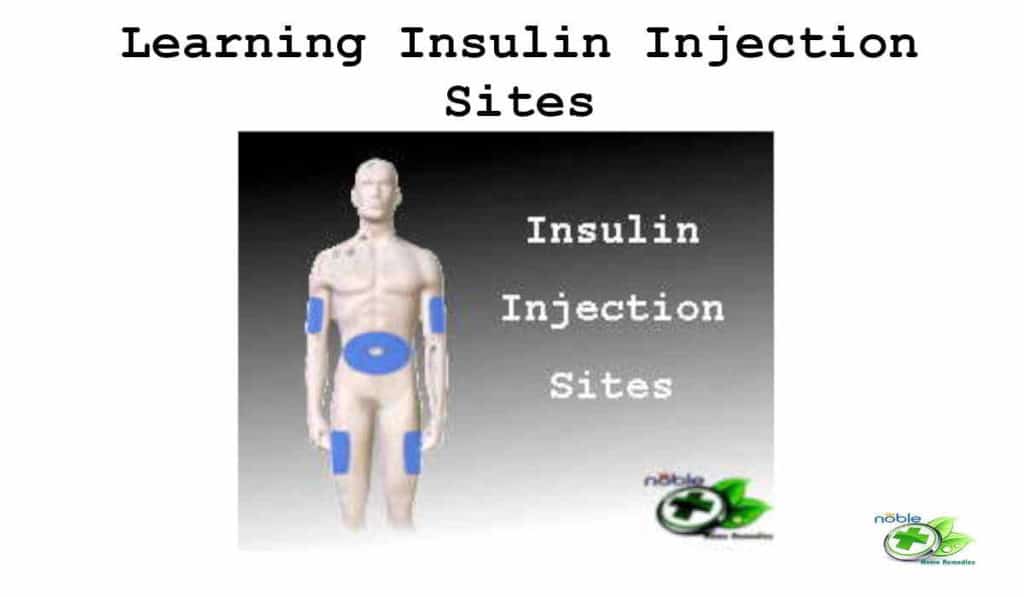 Learning Insulin Injection Sites