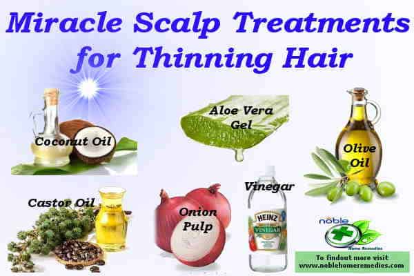 Miracle Scalp Treatment for Thinning Hair guide