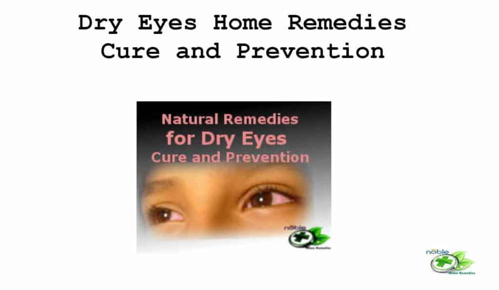 Natural Remedies For Dry Eyes - Cure and Prevention