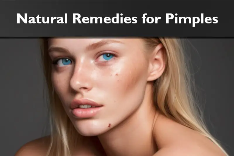 Natural Remedies for Pimples