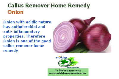 Onion - Callus remover home remedy