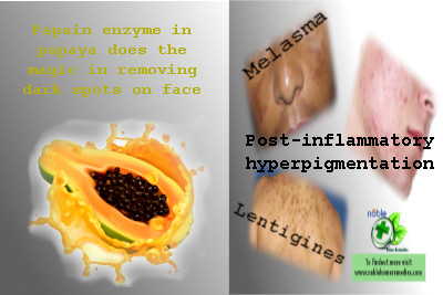 Papain in Papaya removes Dark Spots on Face