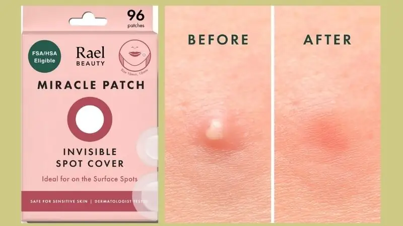 Rael Pimple Patches