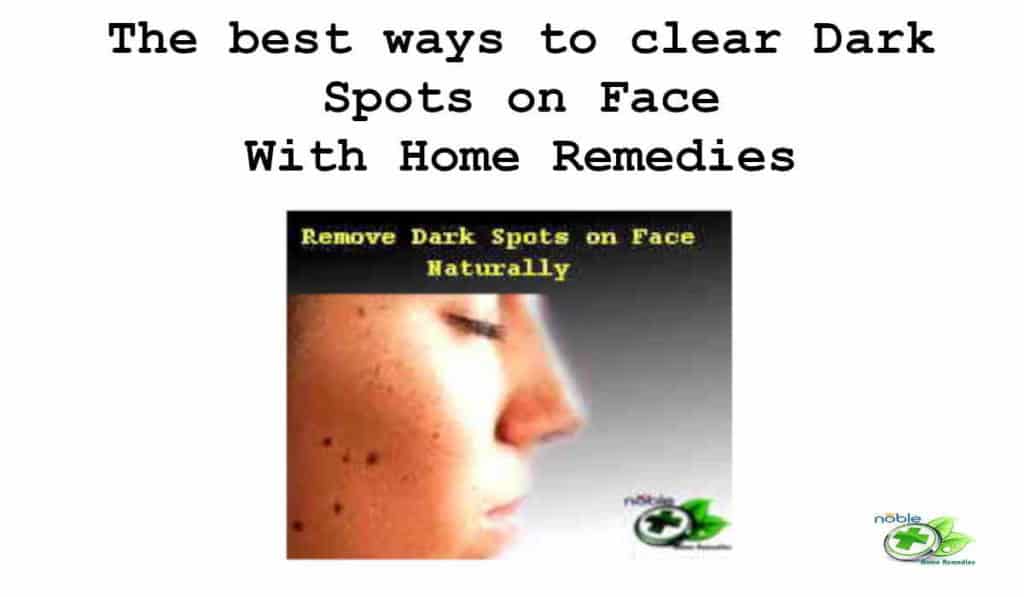 Remove Dark Spots On Face