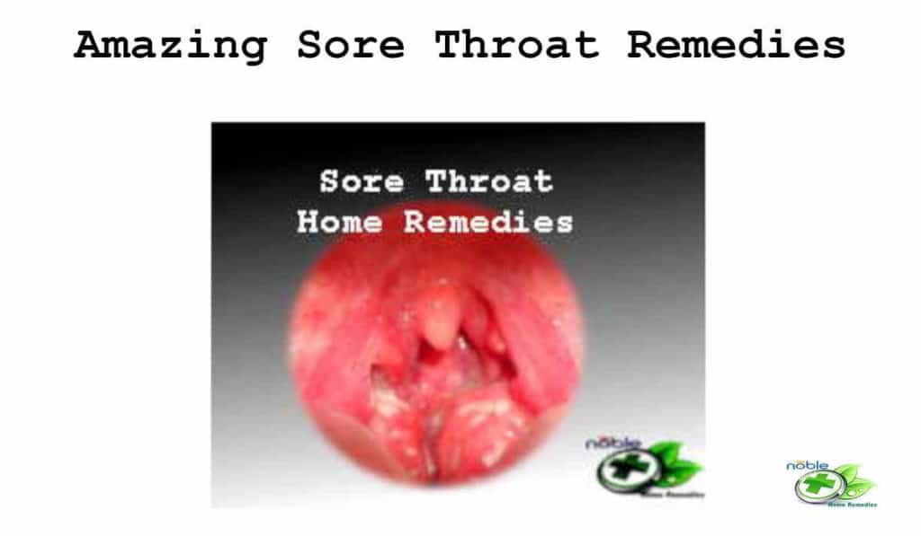 Sore Throat Home Remedies