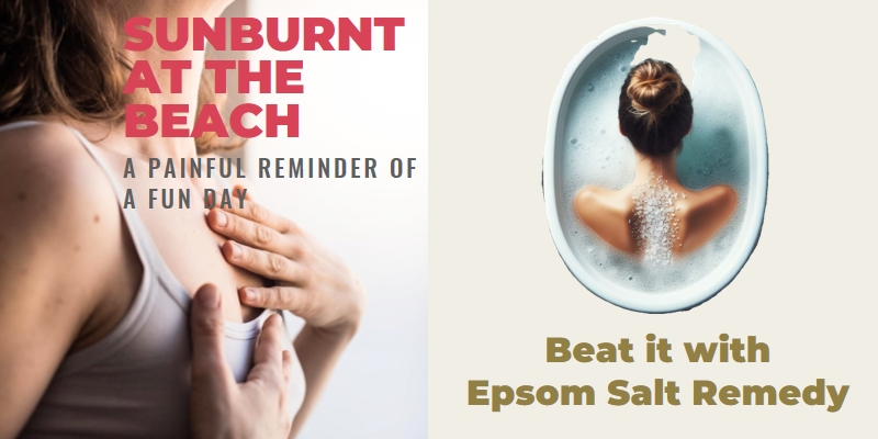 Epsom salt for sunburn treatment