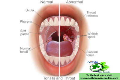 Throat Anatomy with Tonsils