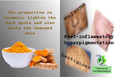 Turmeric removes Dark Spots on Face