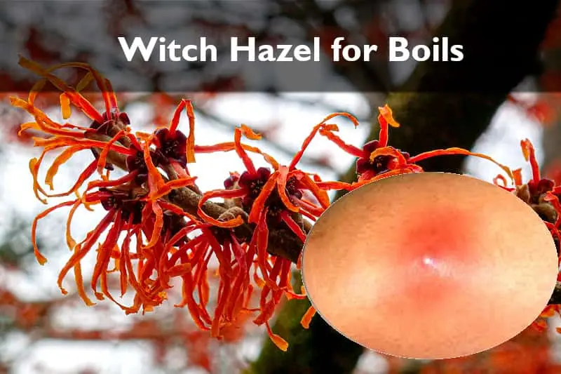 Witch Hazel for boils