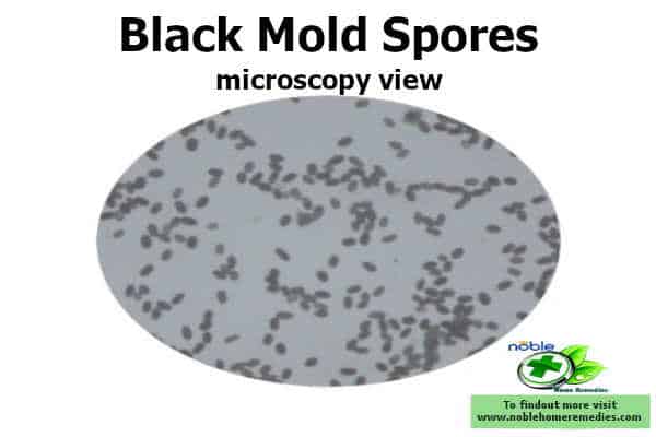 Microscopy view of Black Mold Spores