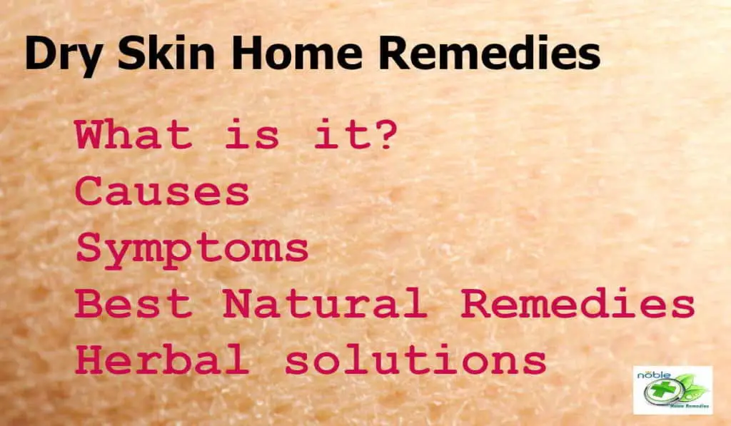 Dry skin natural remedies